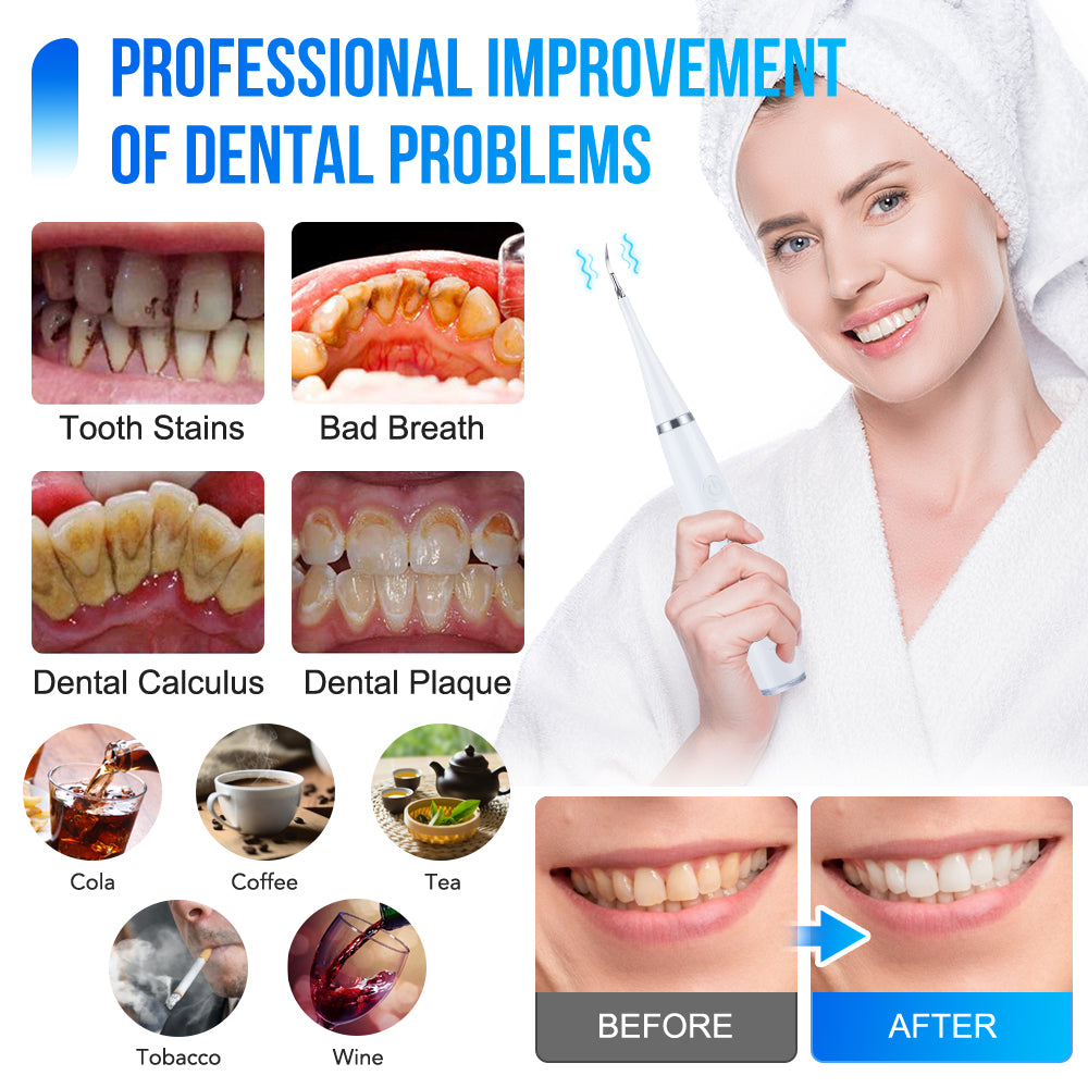 Electric Dental Teeth Cleaner Beauty